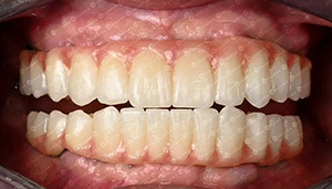 последний случай компании о Случай с клиентом. 4D цирконийный блок.