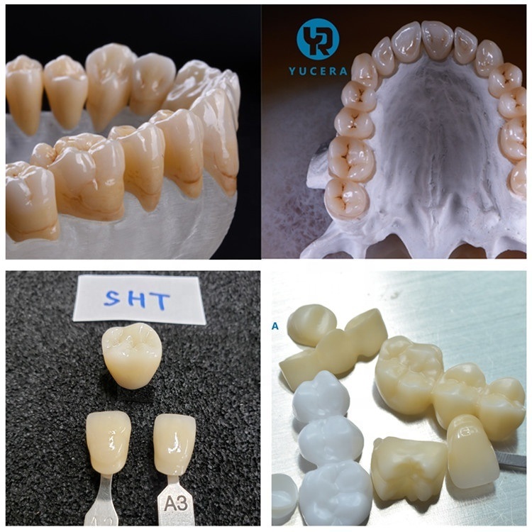 Yucera SHT Multilayer Zirconia Block 95 mm  Dental Material CAD CAM Crown and Bridge