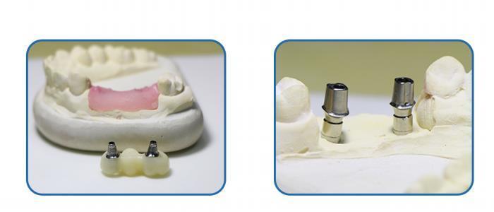 Yucera GSL-5T 5 Axis Digital Cad Cam 98 Open System Milling Machine Dental Dry/wet Cnc for Dental Lab