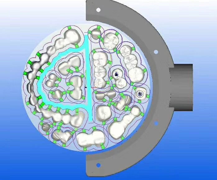5Axis CAD/CAM Dental Milling Machine for  Dental Zirconia Blocks and Dental Equipment/Unit and Dental Lab